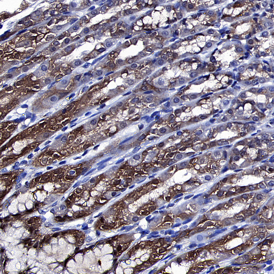 Golgin-245 Recombinant Rabbit mAb (S-4473-8)