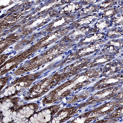 Golgin-245 Recombinant Rabbit mAb (S-4473-8)