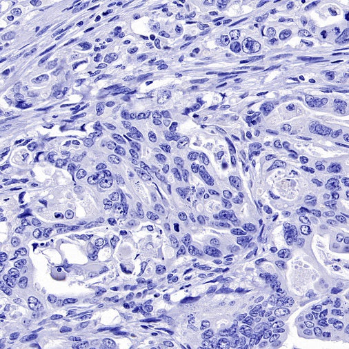 CaMKII alpha Recombinant Rabbit mAb (S-2451-54)