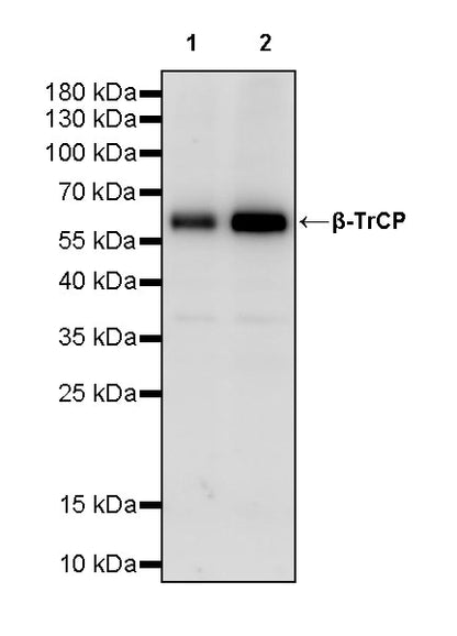 β-TrCP Recombinant Rabbit mAb (S-3941-63)