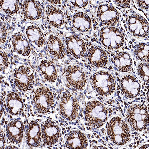 Fumarate hydratase Rabbit Polyclonal Antibody