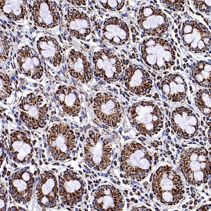 Fumarate hydratase Rabbit Polyclonal Antibody