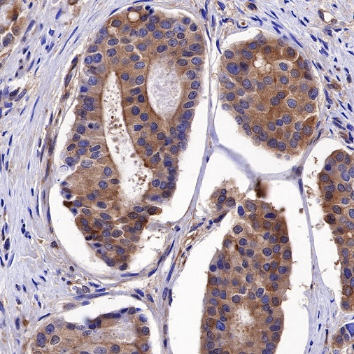 Calpastatin Recombinant Rabbit mAb (S-R184)