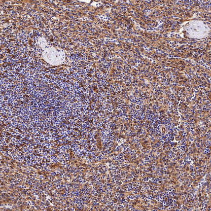 STING Recombinant Rabbit mAb (SDT-R150)