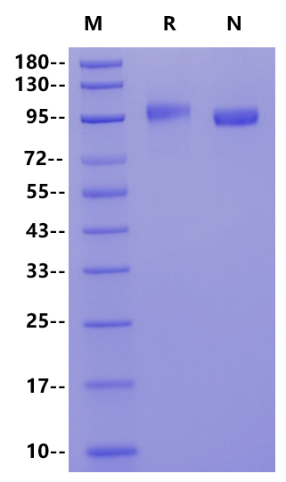 PTK7/CCK4 His Tag Protein, Mouse