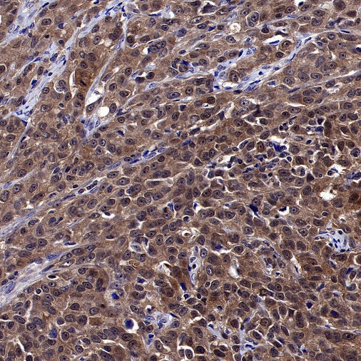 GSDMD Recombinant Rabbit mAb (S-3267)
