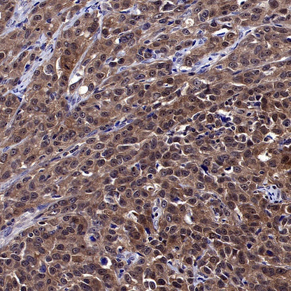 GSDMD Recombinant Rabbit mAb (S-3267)