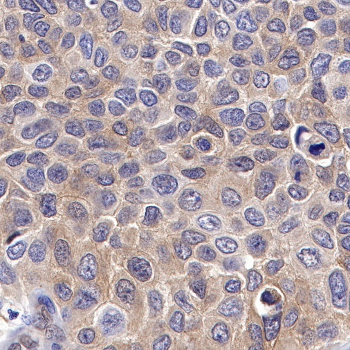 PTP1B Recombinant Rabbit mAb (S-R304)