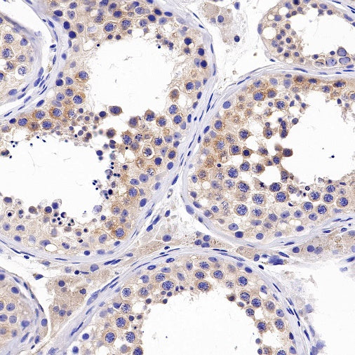 Beclin-1 Recombinant Rabbit mAb (S-761-15)