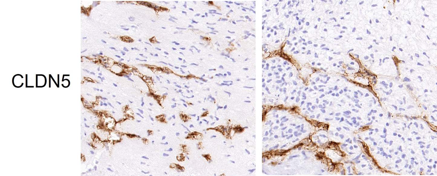 VEGF-121 Protein, Human