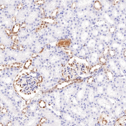 S100A11 Recombinant Rabbit mAb (S-821-4)