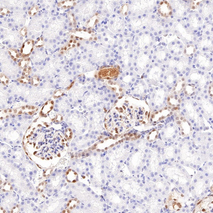 S100A11 Recombinant Rabbit mAb (S-821-4)