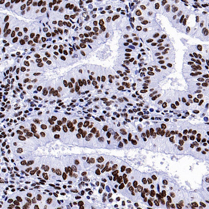 Histone H4 (acetyl K5 + K8 + K12 + K16) Recombinant Rabbit mAb (S-902-37)