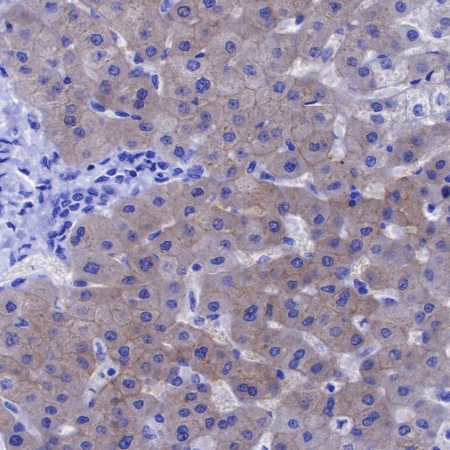 CTEN Recombinant Rabbit mAb (SDT-R175)