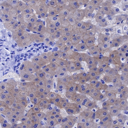 CTEN Recombinant Rabbit mAb (SDT-R175)