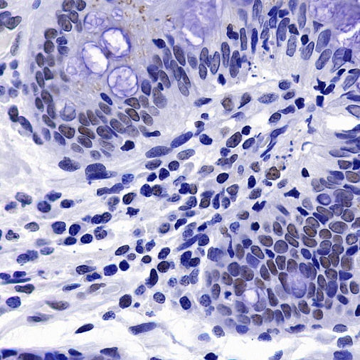S-RMab® PMS2 Recombinant Rabbit mAb (SDT-R460)