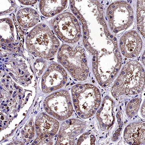 Bax Recombinant Rabbit mAb (S-2603-124)