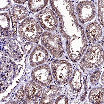 Bax Recombinant Rabbit mAb (S-2603-124)