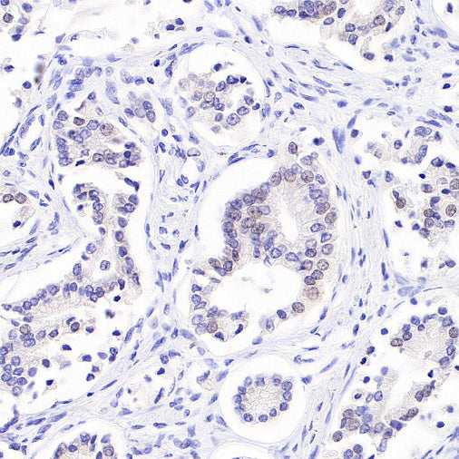 S-RMab® ErbB3 Recombinant Rabbit mAb (SDT-991-10)