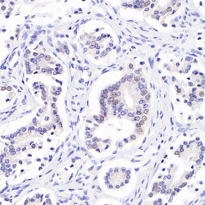 S-RMab® ErbB3 Recombinant Rabbit mAb (SDT-991-10)