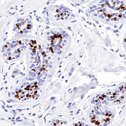 Estrogen Receptor α Recombinant Rabbit mAb (SDT-R371)