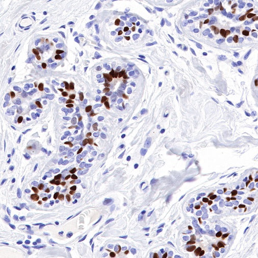 Estrogen Receptor α Recombinant Rabbit mAb (SDT-R371)