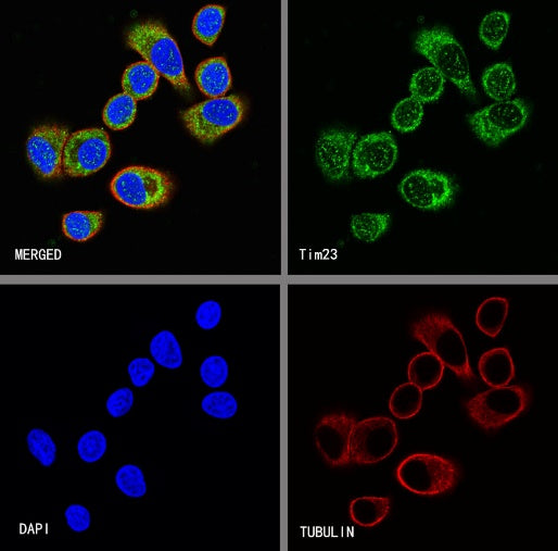 Tim23 Recombinant Rabbit mAb (S-2241-105)