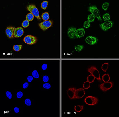 Tim23 Recombinant Rabbit mAb (S-2241-105)