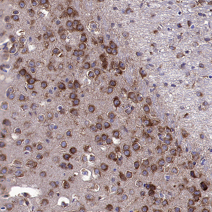 HSP90 alpha/beta Recombinant Mouse mAb (S-5282)