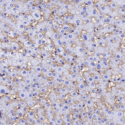 NaK-ATPase Recombinant Rabbit mAb (S-1373-39)