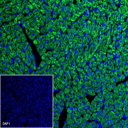 S-RMab® Desmin Recombinant Rabbit mAb (SDT-109-114)