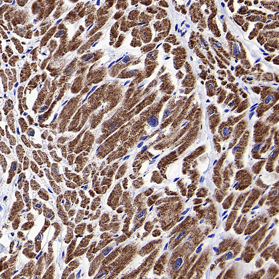 ATPIF1 Recombinant Rabbit mAb (S-3849-49)
