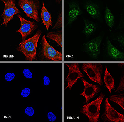 CDK6 Recombinant Rabbit mAb (SDT-R047)