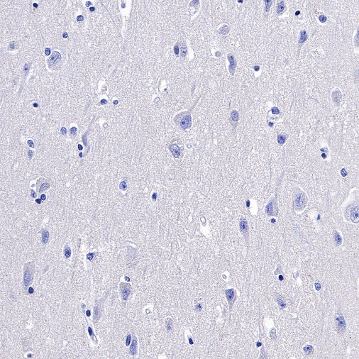 5T4 Recombinant Rabbit mAb (S-R361)