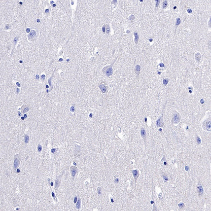 5T4 Recombinant Rabbit mAb (S-R361)