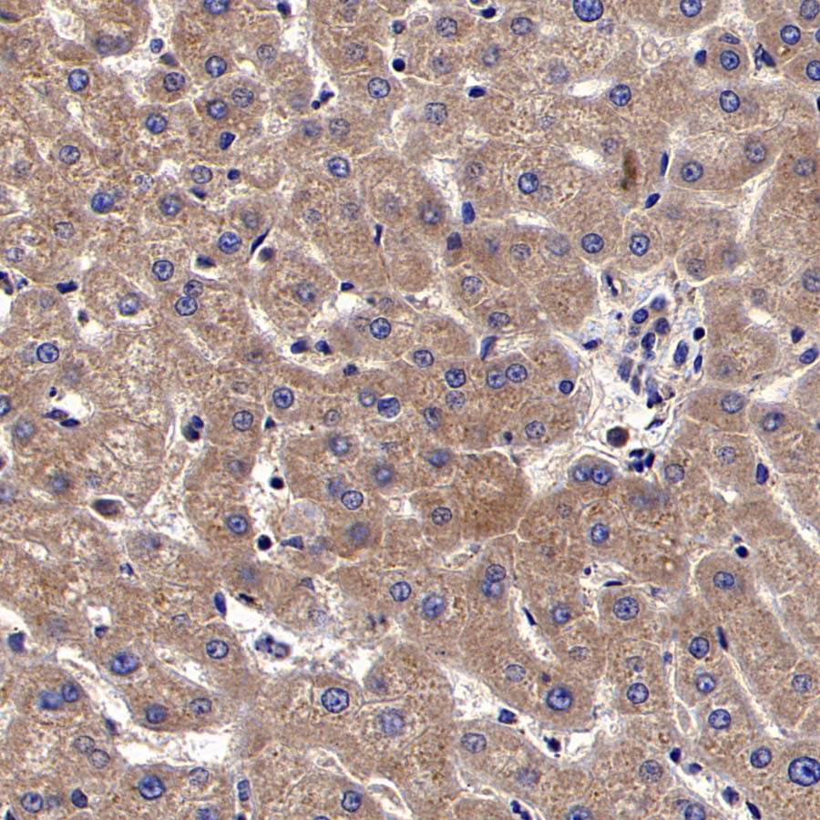 RPS14 Rabbit Polyclonal Antibody