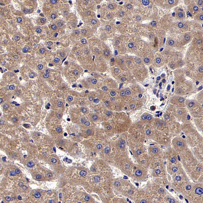 RPS14 Rabbit Polyclonal Antibody