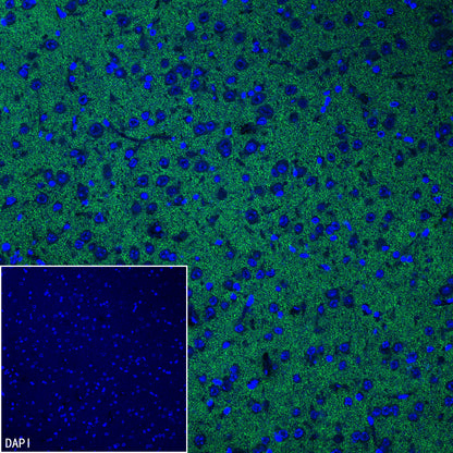 Homer1 Recombinant Rabbit mAb (S-3405-360)