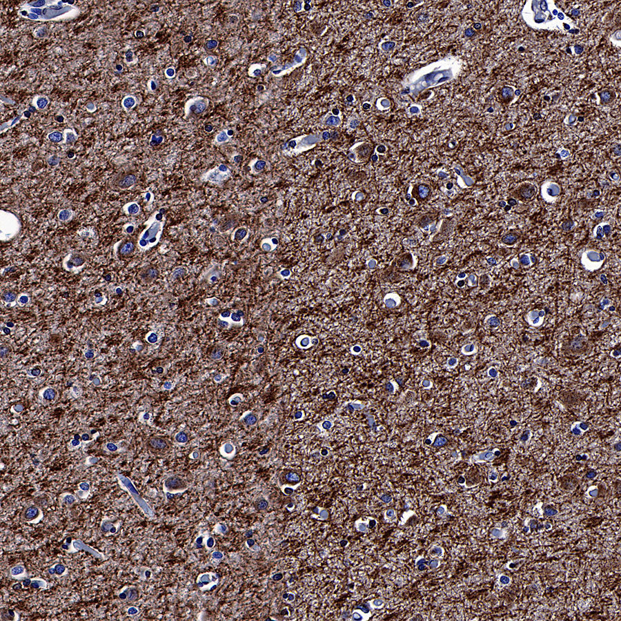 APP Recombinant Rabbit mAb