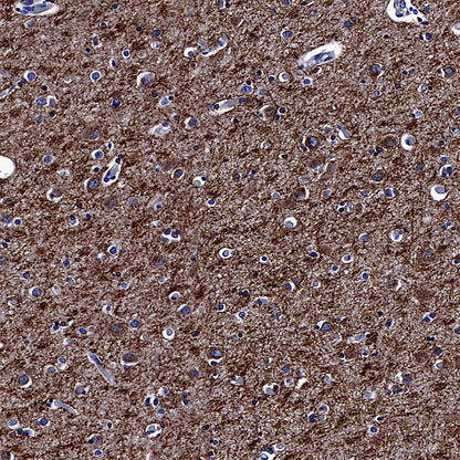 APP Recombinant Rabbit mAb