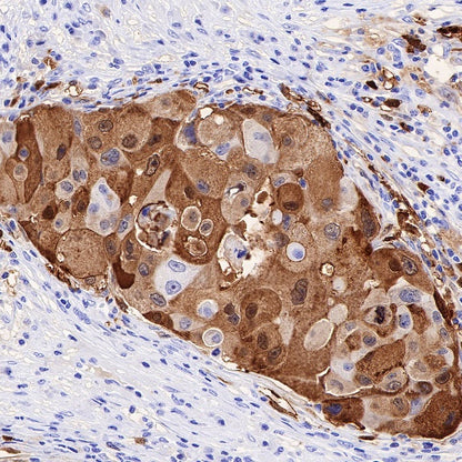 S100A8/MRP8 Recombinant Rabbit mAb (S-R251)