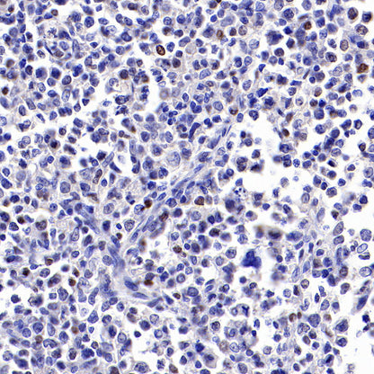 S-RMab® c-Myc Recombinant Rabbit mAb (SDT-R138)