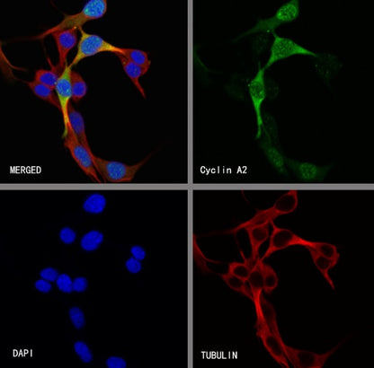 Cyclin A2 Recombinant Rabbit mAb (S-1873-103)