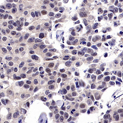 KDM4A Recombinant Rabbit mAb (S-957-138)
