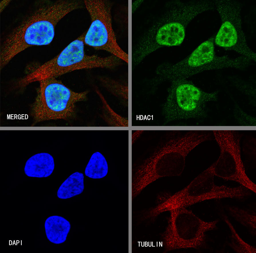 HDAC1 Recombinant Rabbit mAb (SDT-310-72)