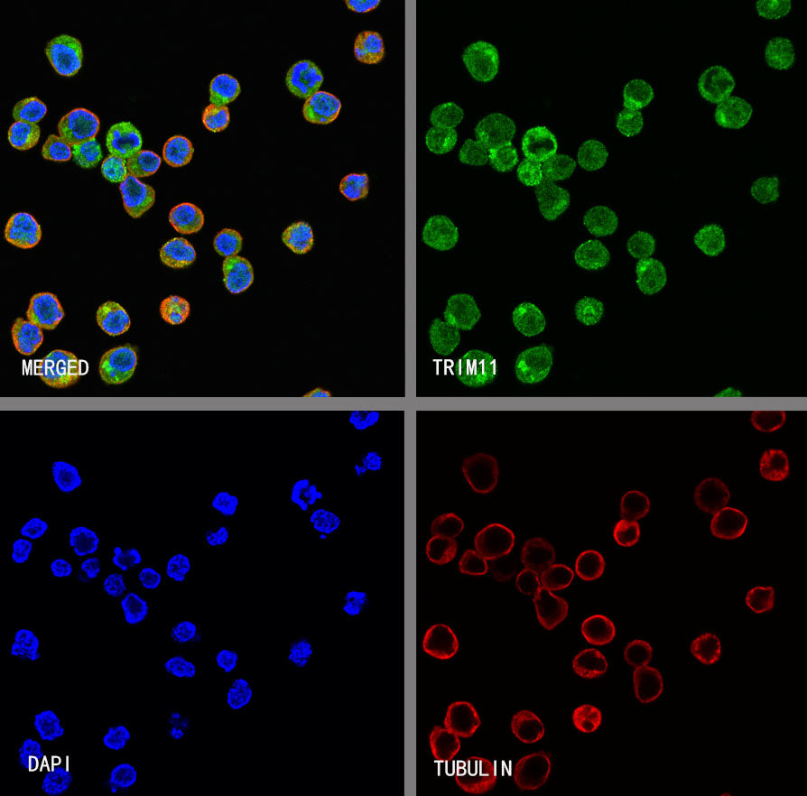 TRIM11 Recombinant Rabbit mAb (S-2913-79)