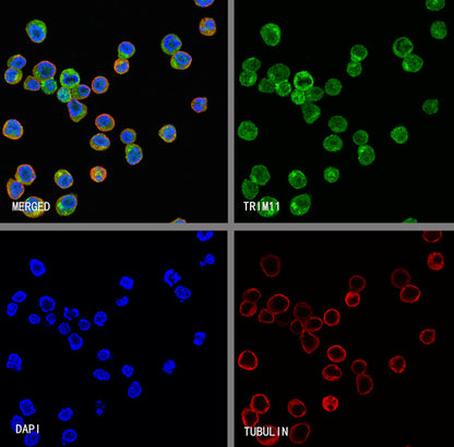 TRIM11 Recombinant Rabbit mAb (S-2913-79)