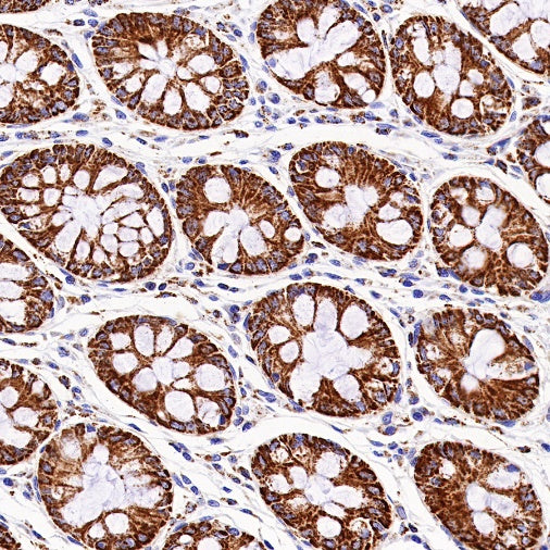 PBR/TSPO Recombinant Rabbit mAb (S-607-19)
