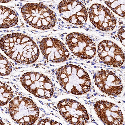 PBR/TSPO Recombinant Rabbit mAb (S-607-19)