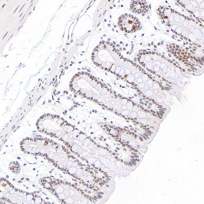 Phospho-STAT1 (Ser727) Recombinant Rabbit mAb